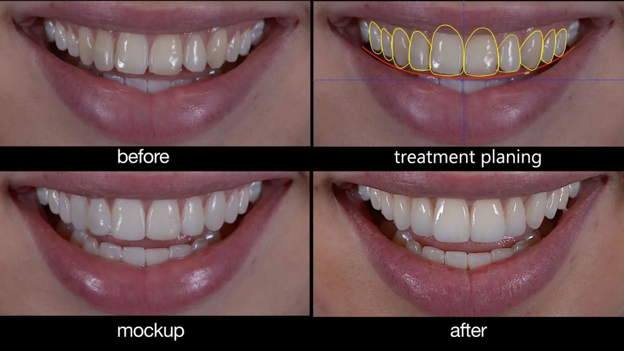 Smile Designing And Cosmetic Dentistry view 3