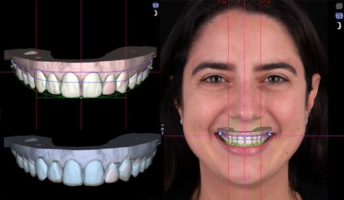 Smile Designing And Cosmetic Dentistry view 2