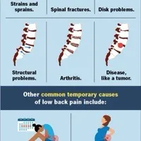 Lower Back Pain view 3