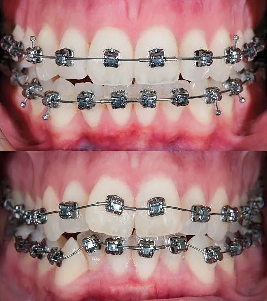 Ortho Treatments view 3