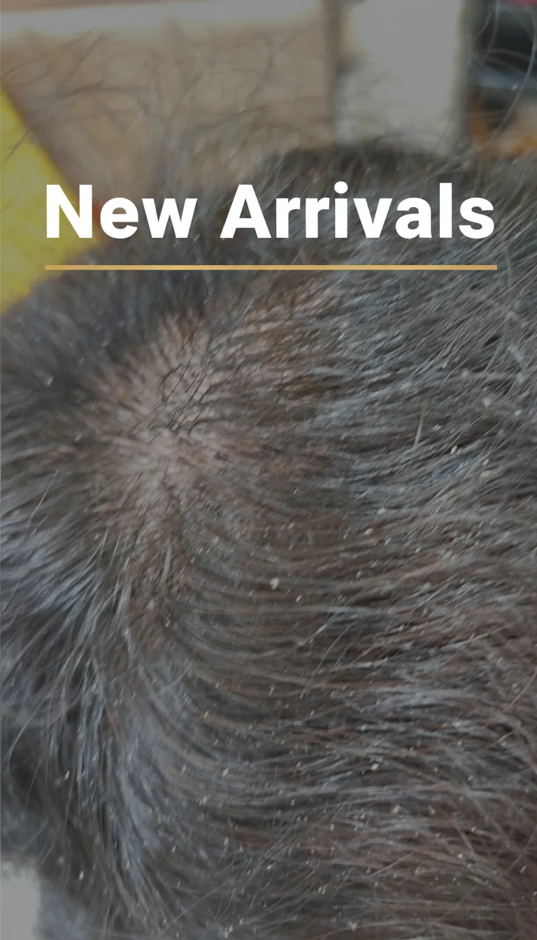 Basic Scalp Treatment In Salon view 3