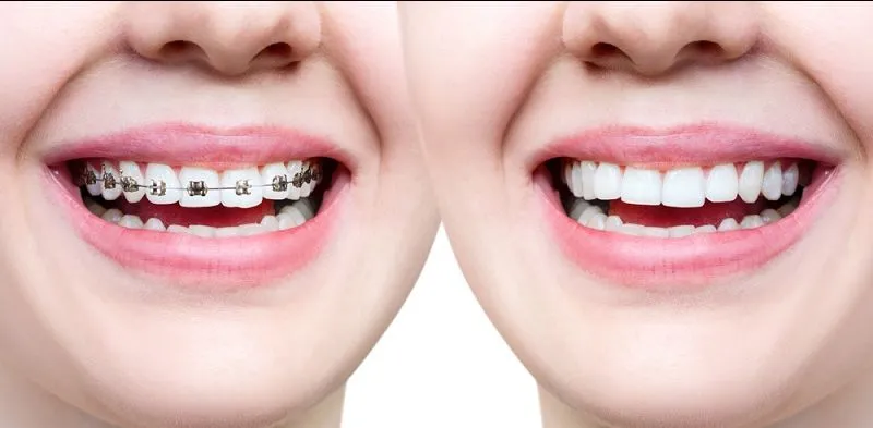 Ortho Treatments view 2