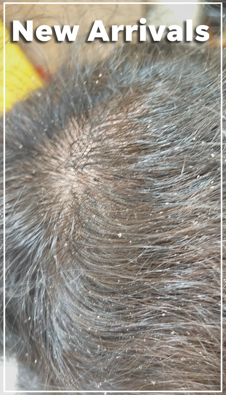 Basic Scalp Treatment In Salon view 4