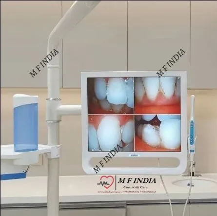 Intra Oral Camera