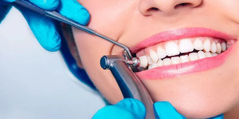 Teeth Cleaning And Polishing view 3