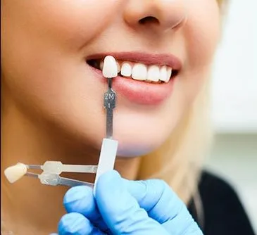 Smile Designing And Cosmetic Dentistry view 4
